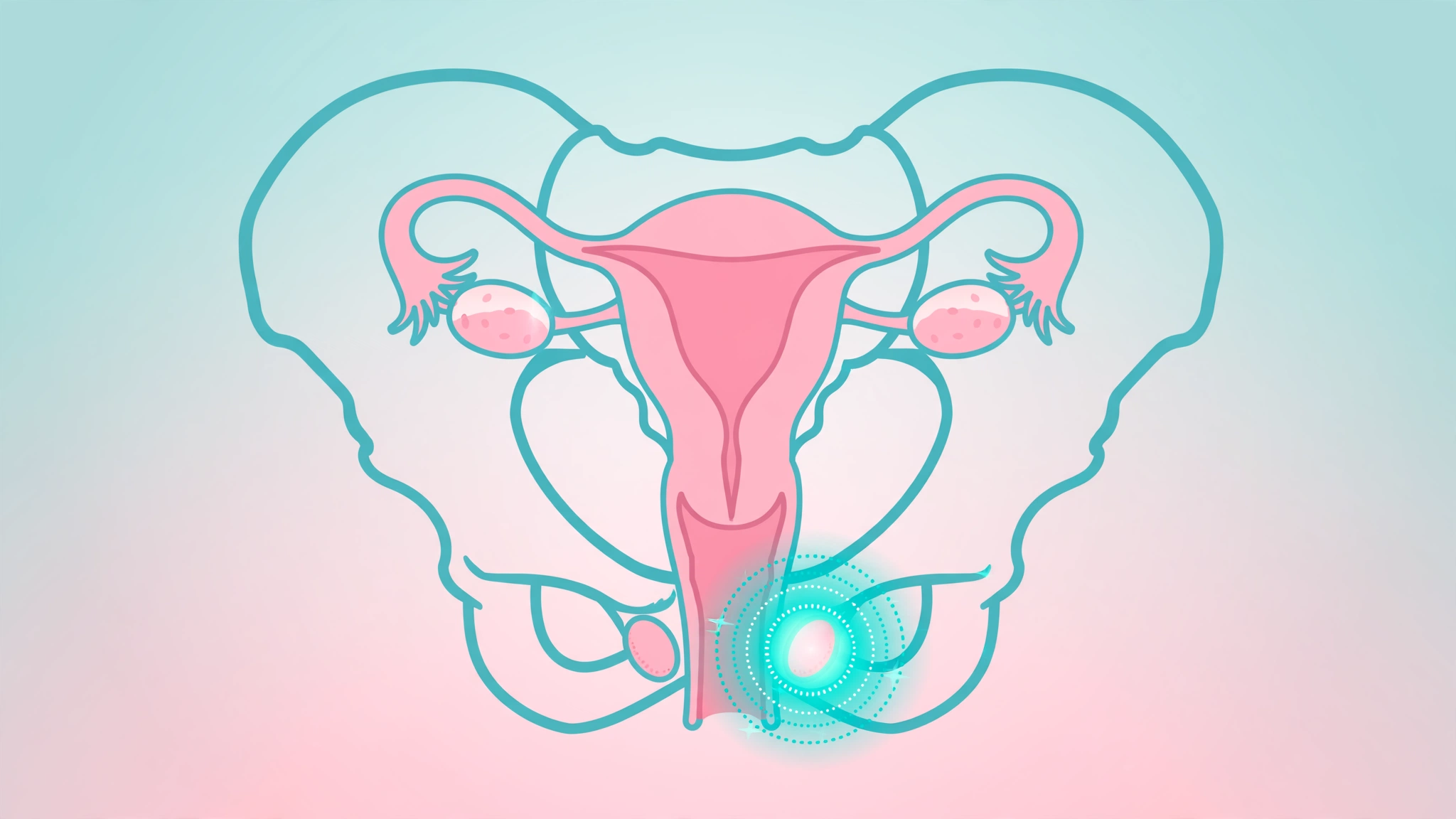 Anatomical illustration showing bartholin cyst treatment options near the vaginal opening