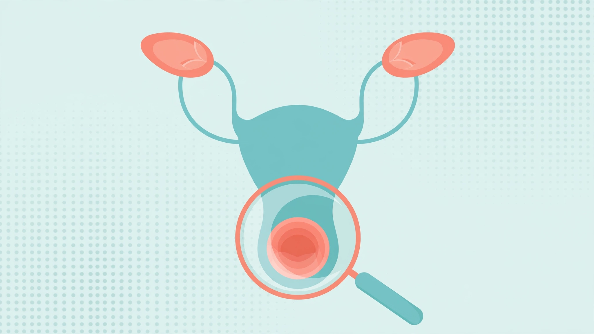 Medical illustration highlighting common bleeding after sex causes in cervical and vaginal health
