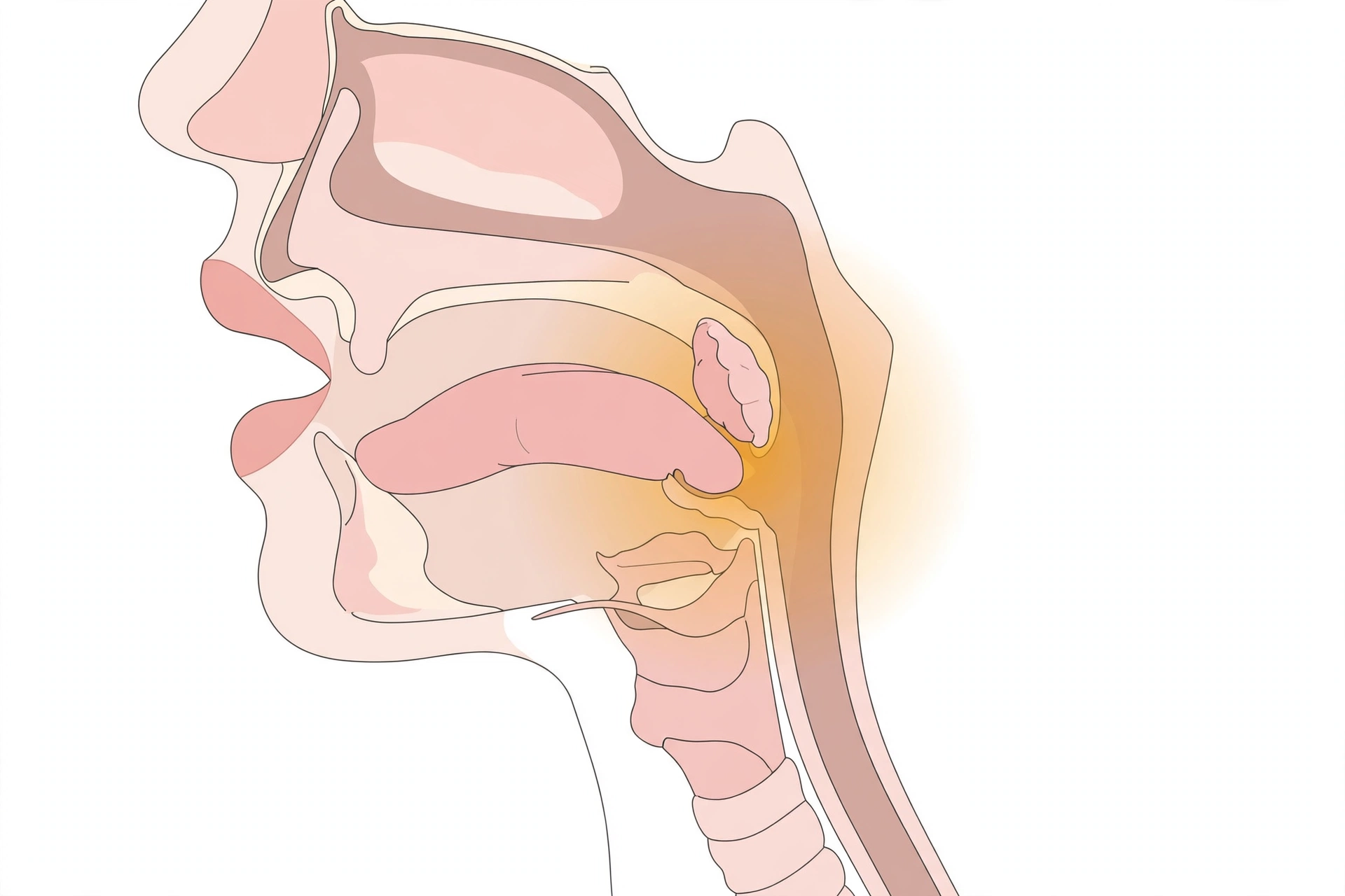 Clinical anatomical diagram of the throat highlighting the tonsils and base of tongue in the oropharynx
