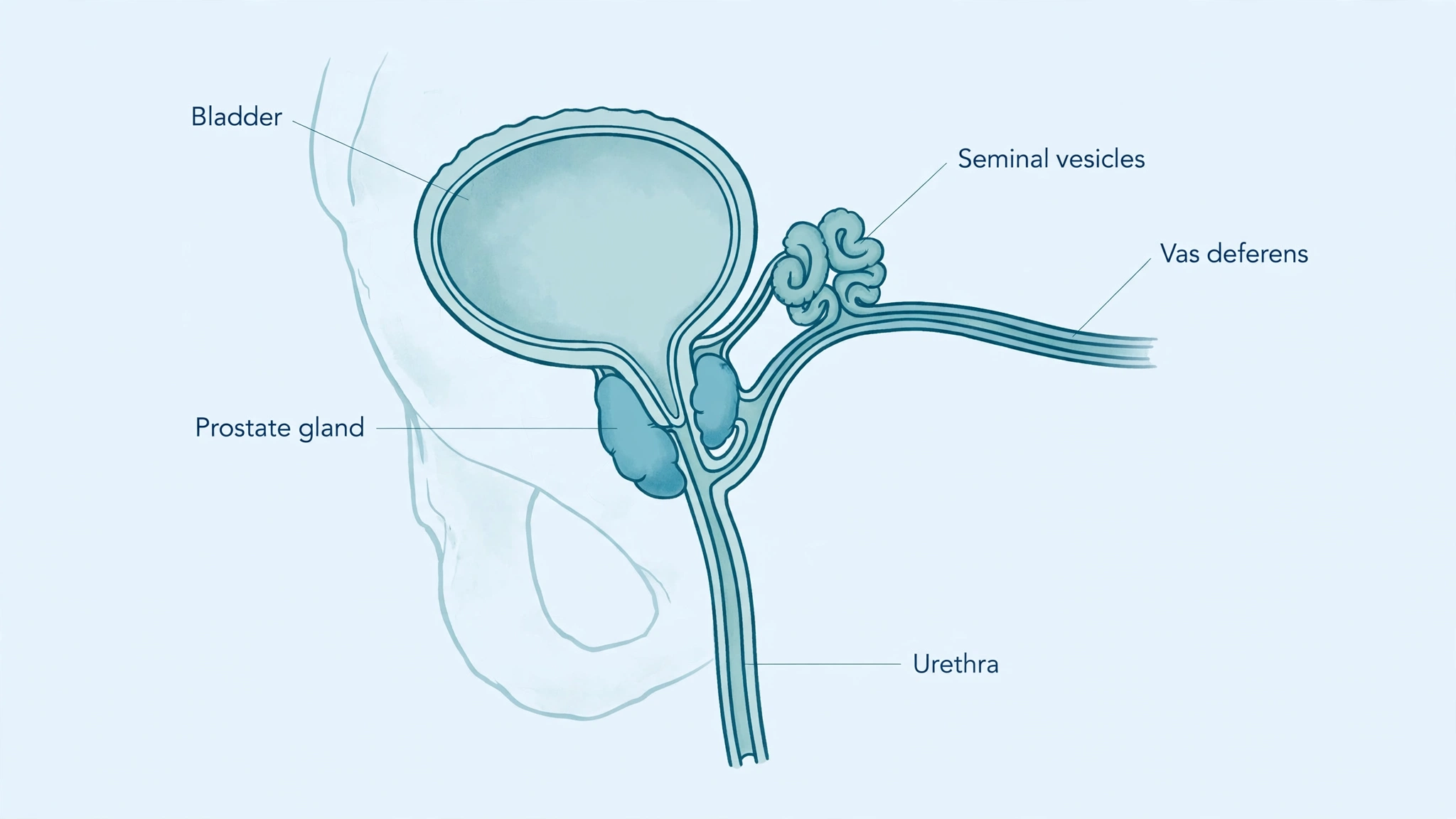 Educational medical diagram of the male reproductive and urinary system showing the prostate and seminal vesicles, common sites of blood in semen causes