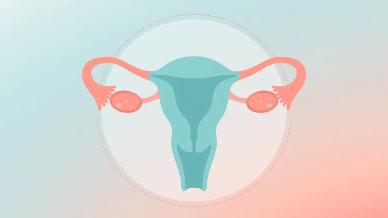 pid symptoms signs — illustrated pelvic health guide